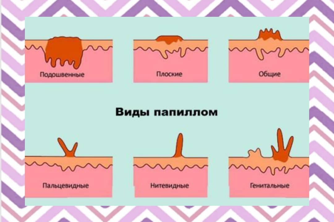 Много пить воды: полезно или нет, вред и польза